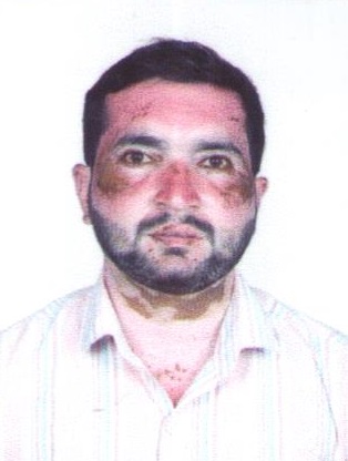Ashvin Arjun Bhujang